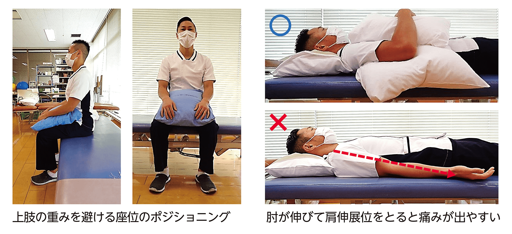 Know more about Rehab:肩関節周囲炎（五十肩） | ORTHO Times