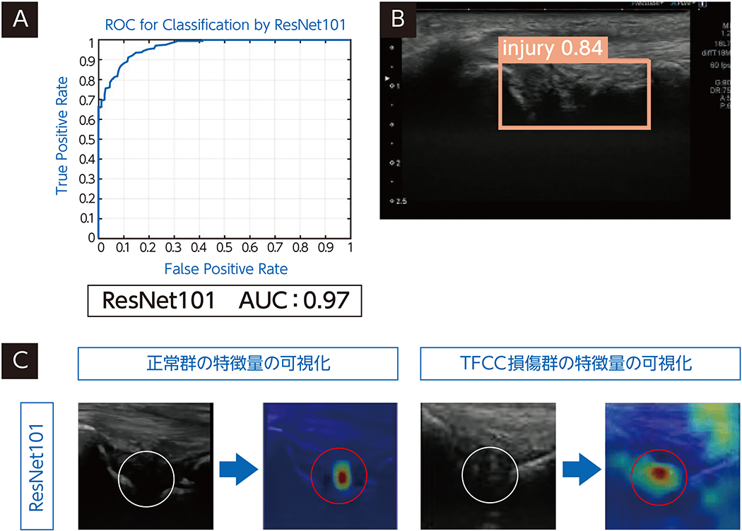 ORTHO DIAGNOSTIC Imaging:エコーとAIで診断するTFCC損傷 | ORTHO