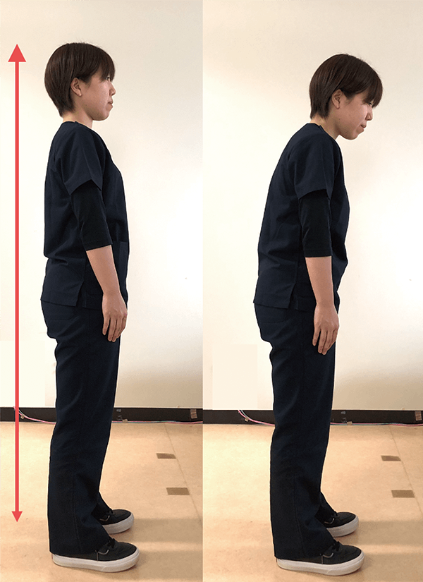 Know more about Rehab:脊椎疾患のリハビリテーション | ORTHO Times