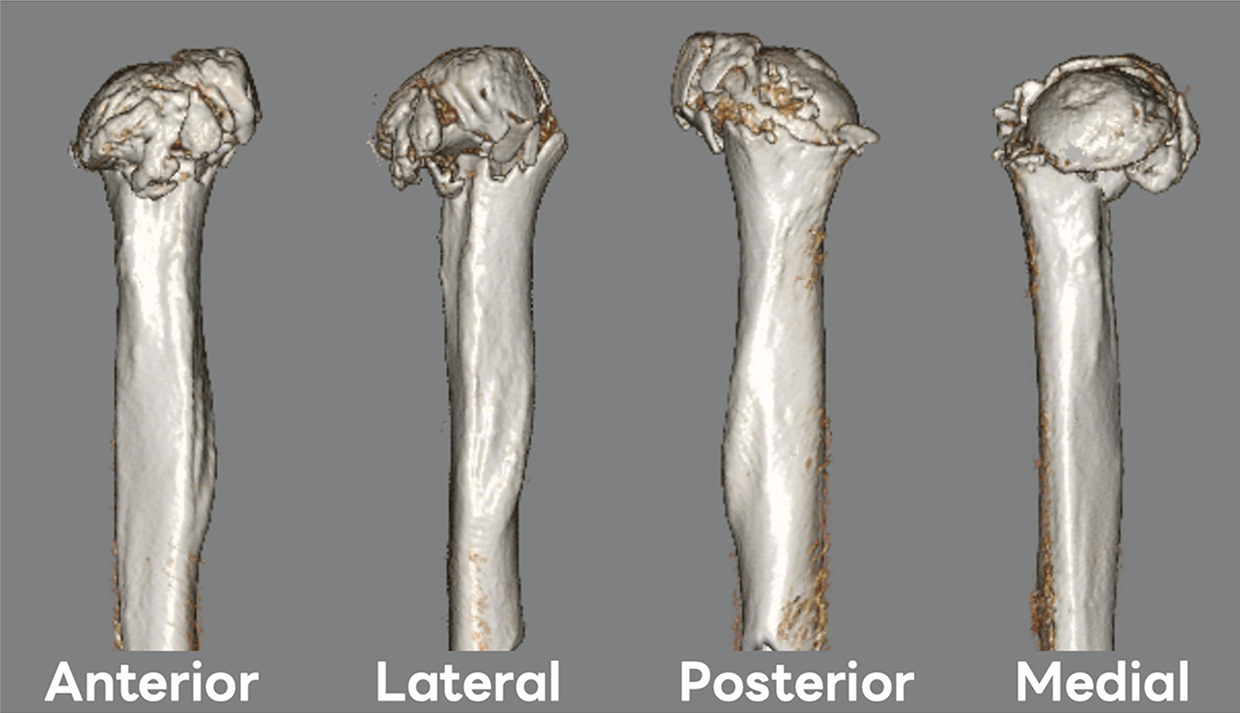 Questionnaire:上腕骨近位部骨折の治療選択 | ORTHO Times | 科研製薬