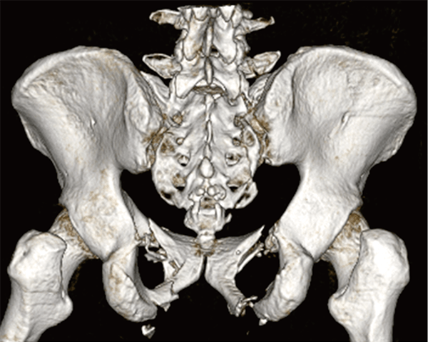 骨折様 VP9 レビュー】VFC VP9 | CarMili+G
