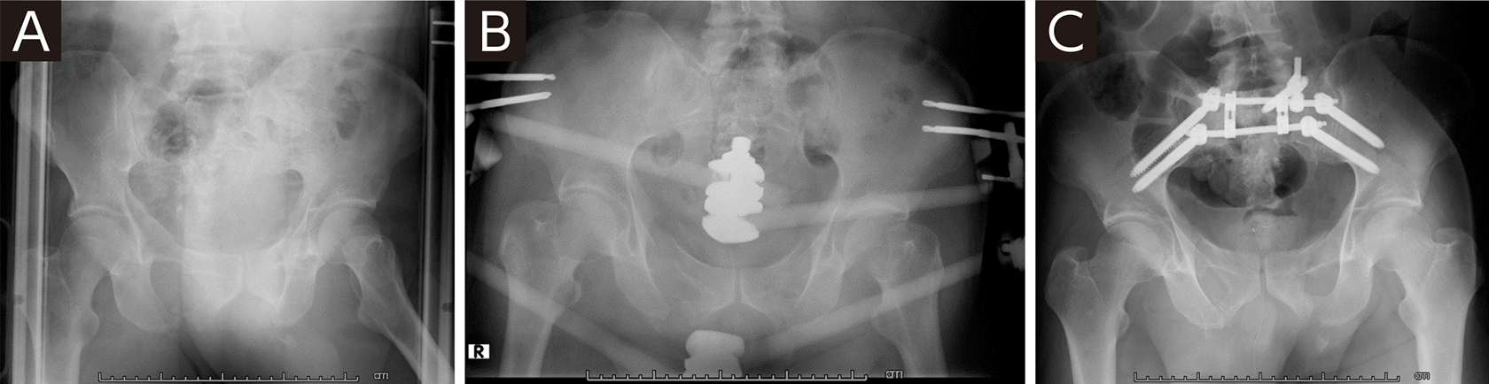 骨折様 VP9 レビュー】VFC VP9 | CarMili+G