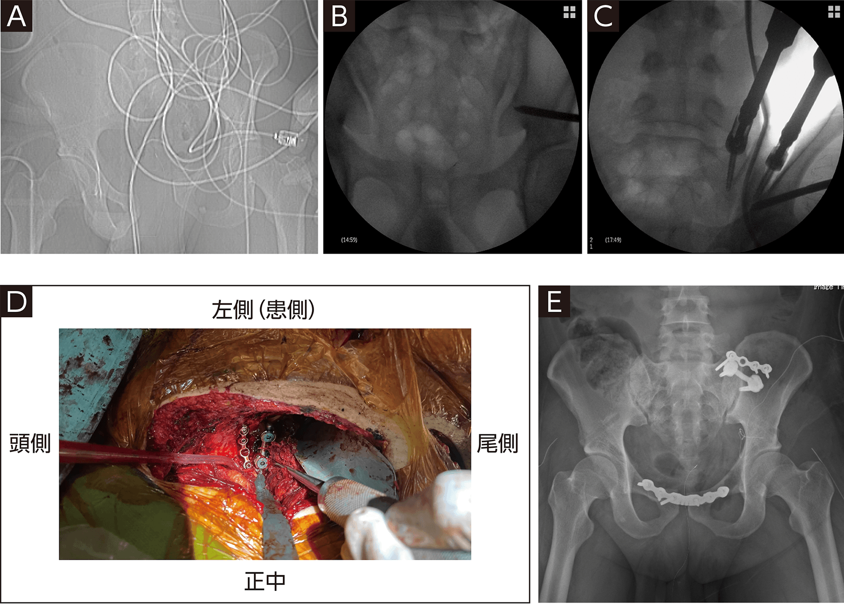 骨折様 VP9 骨折様 VP9 VFC(UMAREX) H&K VP9 GBB（JP.Ver） レビュー | お座敷