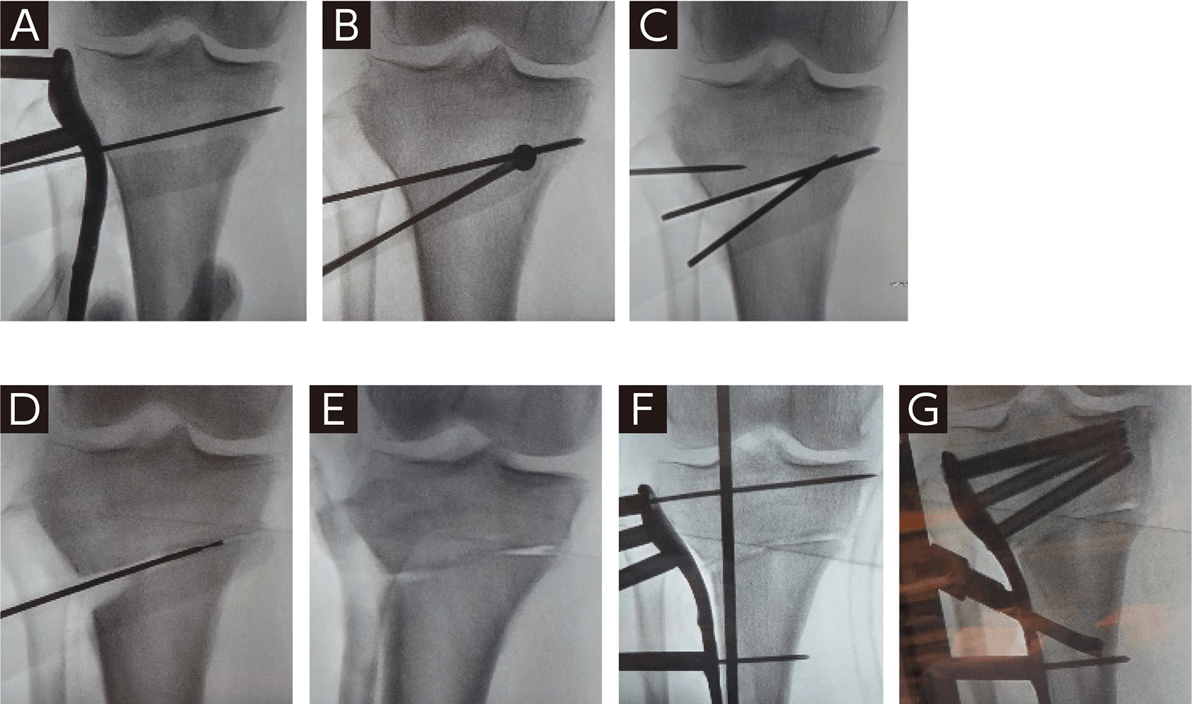 TECHNIQUE UP-TO-DATE:新しい疼痛改善治療 | ORTHO Times | 科研製薬