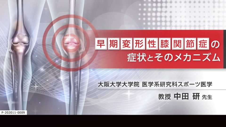 アルツディスポ関節注25mgの診療サポート情報 | 科研製薬 医療関係者