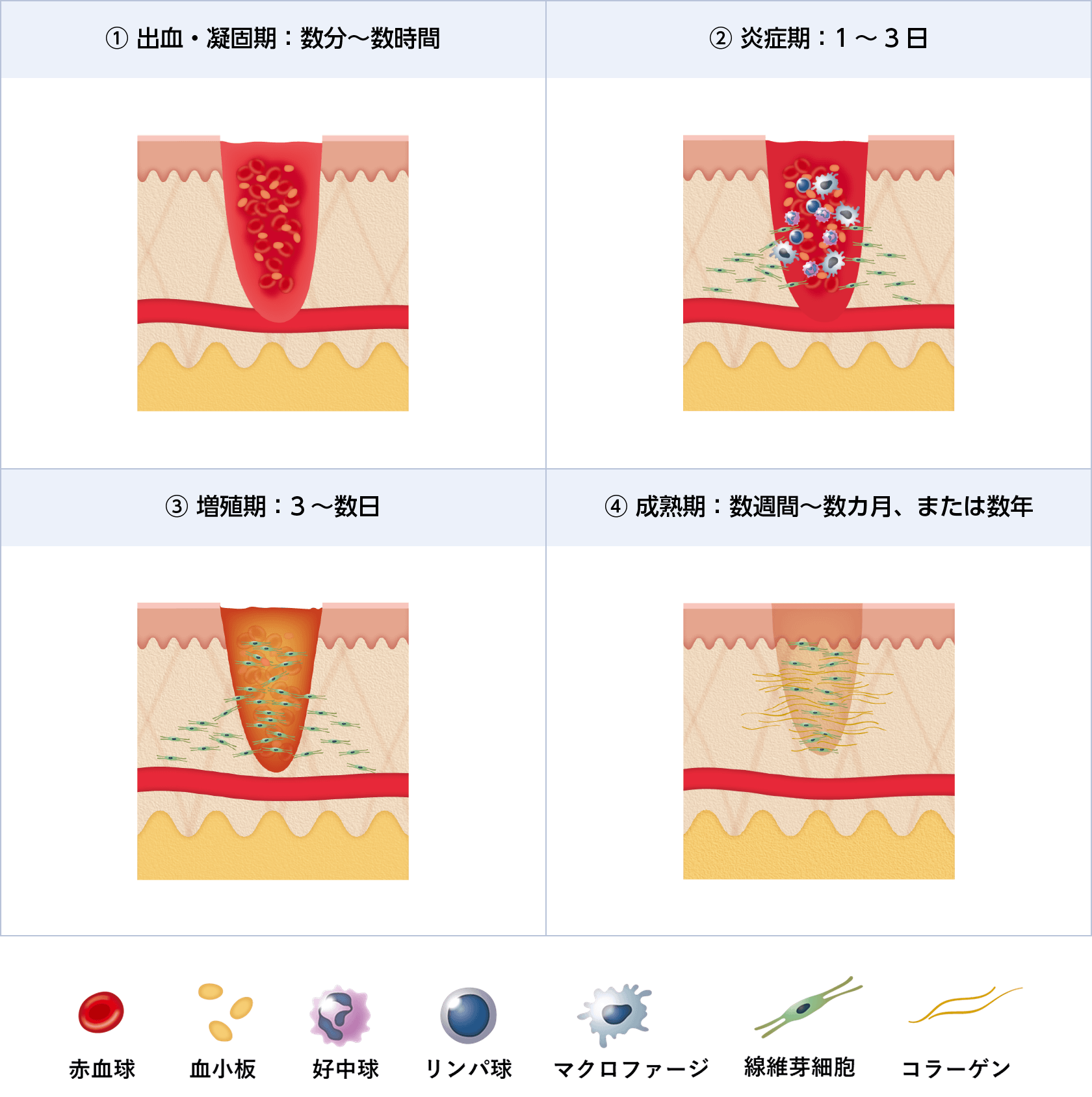 Essentials-創傷治療-:総論 | Essentials-創傷治療- | 科研製薬